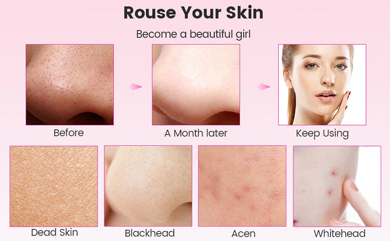 Hello Koul SonicLift Scrubber Pink